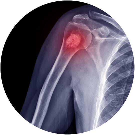 Shoulder MRI Scan Near Me in Gurgaon, Shoulder MRI Scan Cost 2059 Healthians